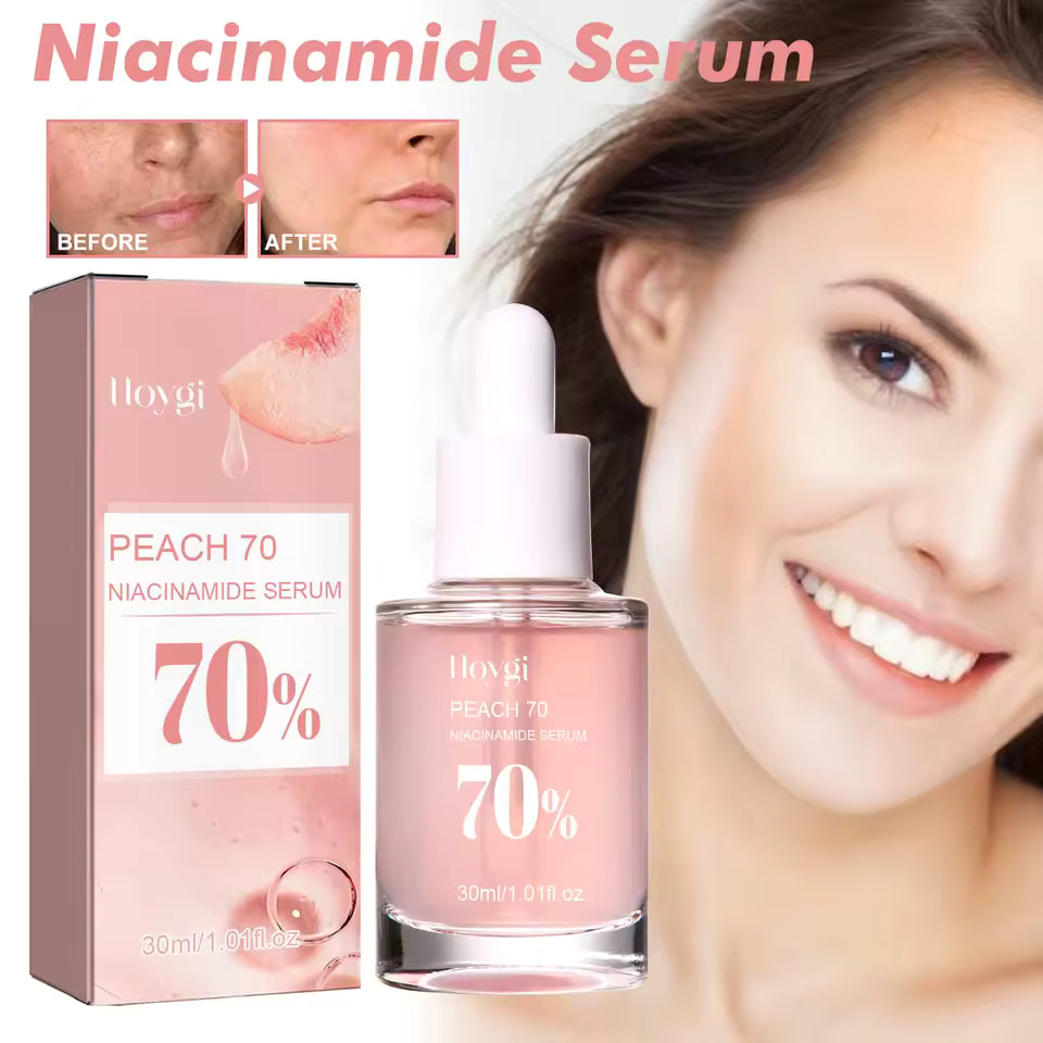 Niacinamide Brightening Serum (30ml) – Pore-Smoothing & Dark Spot Care
