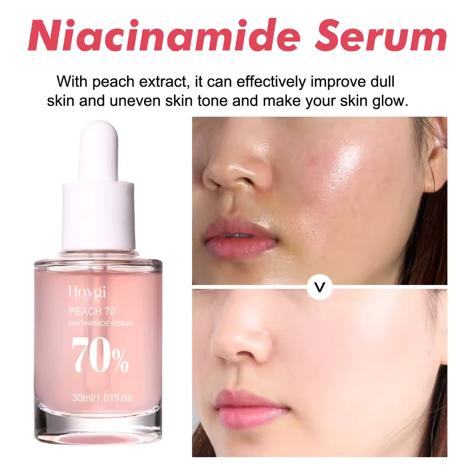 Niacinamide Brightening Serum (30ml) – Pore-Smoothing & Dark Spot Care