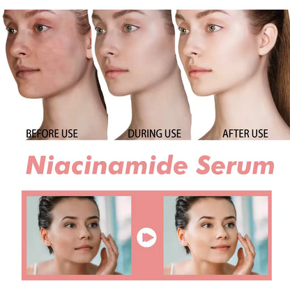 Niacinamide Brightening Serum (30ml) – Pore-Smoothing & Dark Spot Care