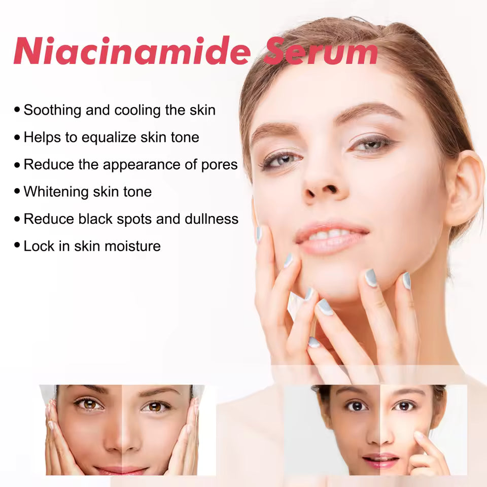 Niacinamide Brightening Serum (30ml) – Pore-Smoothing & Dark Spot Care