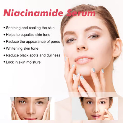 Niacinamide Brightening Serum (30ml) – Pore-Smoothing & Dark Spot Care